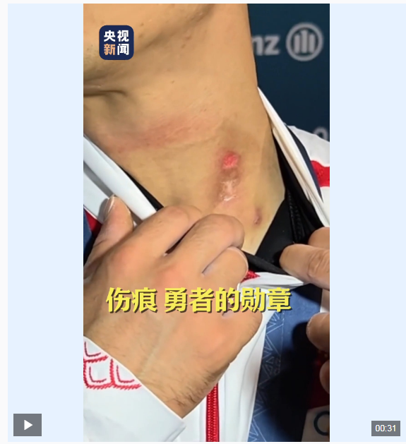 1723266621471948.png image.png